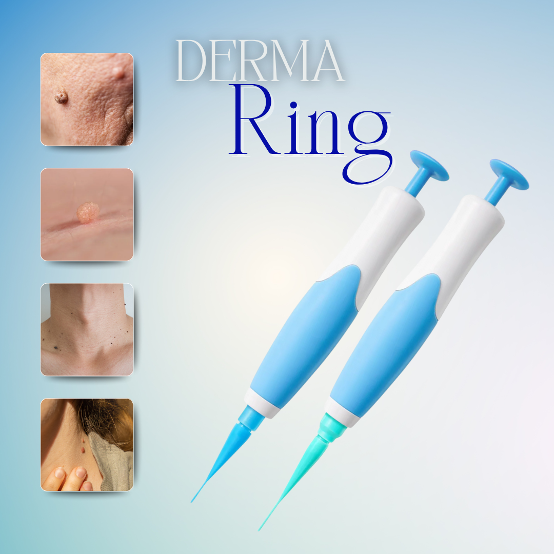 DermaRing